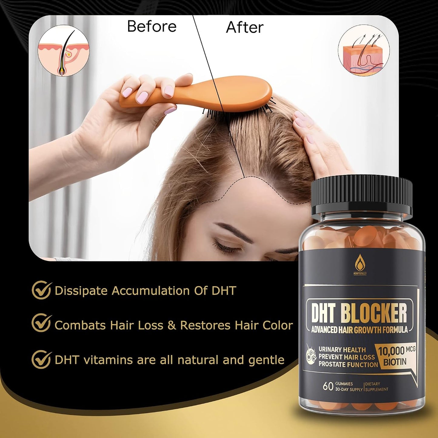 DHT Blocker Hair Growth Gummies – Saw Palmetto + Biotin 10,000Mcg (2-Month Supply)