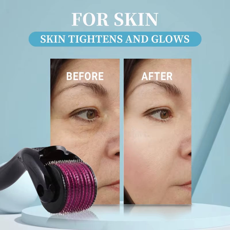 540 Titanium Scalp Derma Roller – Microneedling for Hair & Beard Growth (Sterile)